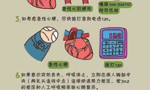 中医急救站：最新心绞痛救治方法与经验分享